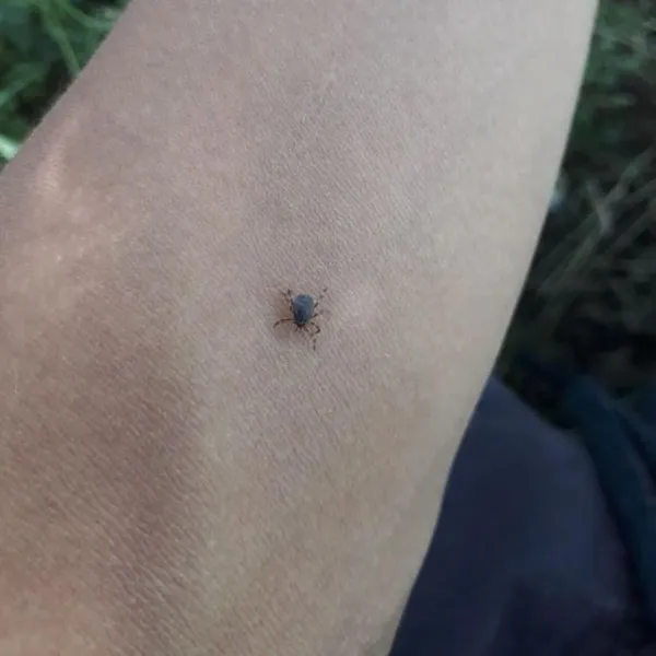 Keneye karşı 'dışarıda uyumayın' uyarısı!
