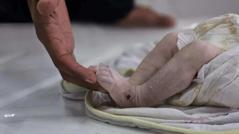 İspanya'dan Gazze'ye Dev Destek! İşte O Milyonlar