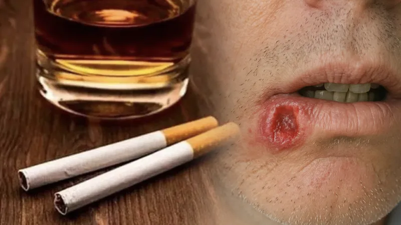 Sigara ve Alkol Kanser Mi Yapıyor? Uzmanlardan Şok Uyarı!